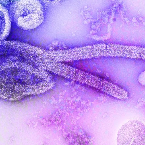 Electron microscopic image of Ebola virus. A healthcare provider donning a pair of green latex gloves in order to protect herself during her subsequent interaction her next patient. Original image sourced from US Government department: Public Health Image Library, Centers for Disease Control and Prevention. Under US law this image is copyright free, please credit the government department whenever you can&rdquo;.