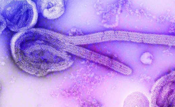 Electron microscopic image of Ebola virus. A healthcare provider donning a pair of green latex gloves in order to protect herself during her subsequent interaction her next patient. Original image sourced from US Government department: Public Health Image Library, Centers for Disease Control and Prevention. Under US law this image is copyright free, please credit the government department whenever you can&rdquo;.