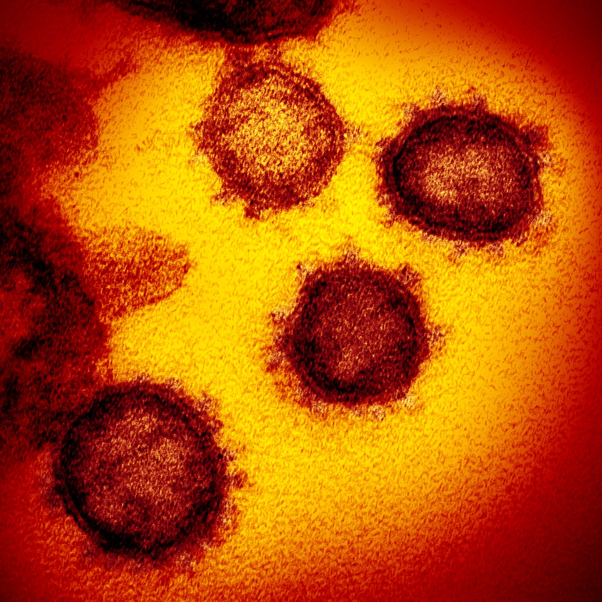 Novel Coronavirus SARS-CoV-2&ndash;This transmission electron microscope image shows SARS-CoV-2&mdash;also known as 2019-nCoV, the virus that causes COVID-19. Original image sourced from US Government department: The National Institute of Allergy and Infectious Diseases. Under US law this image is copyright free, please credit the government department whenever you can&rdquo;.